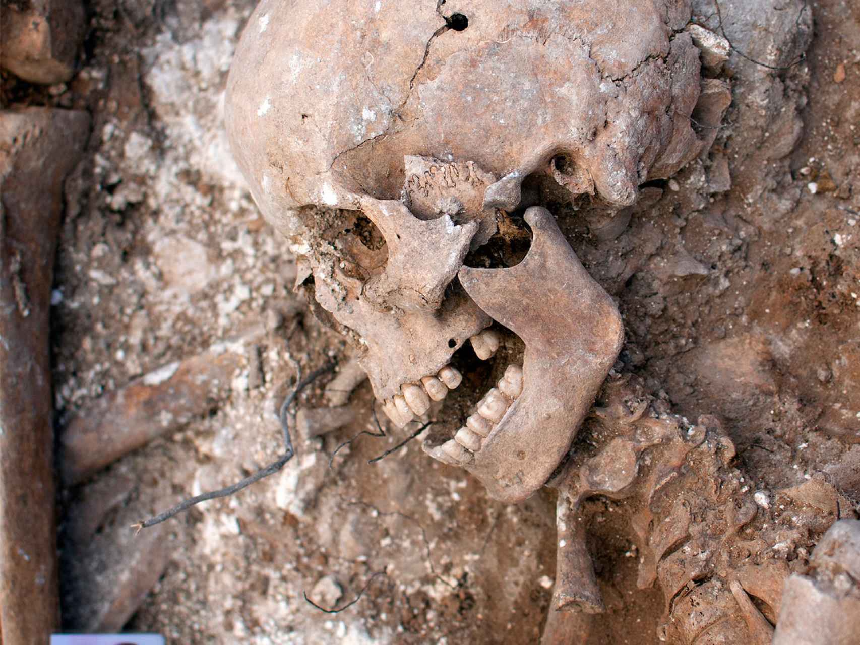 Un cráneo, con un tiro en la sien, en una fosa común en la provincia de Burgos.